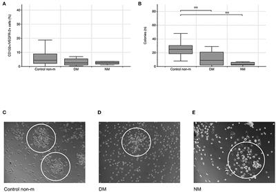 Impairment of muscular endothelial cell regeneration in dermatomyositis